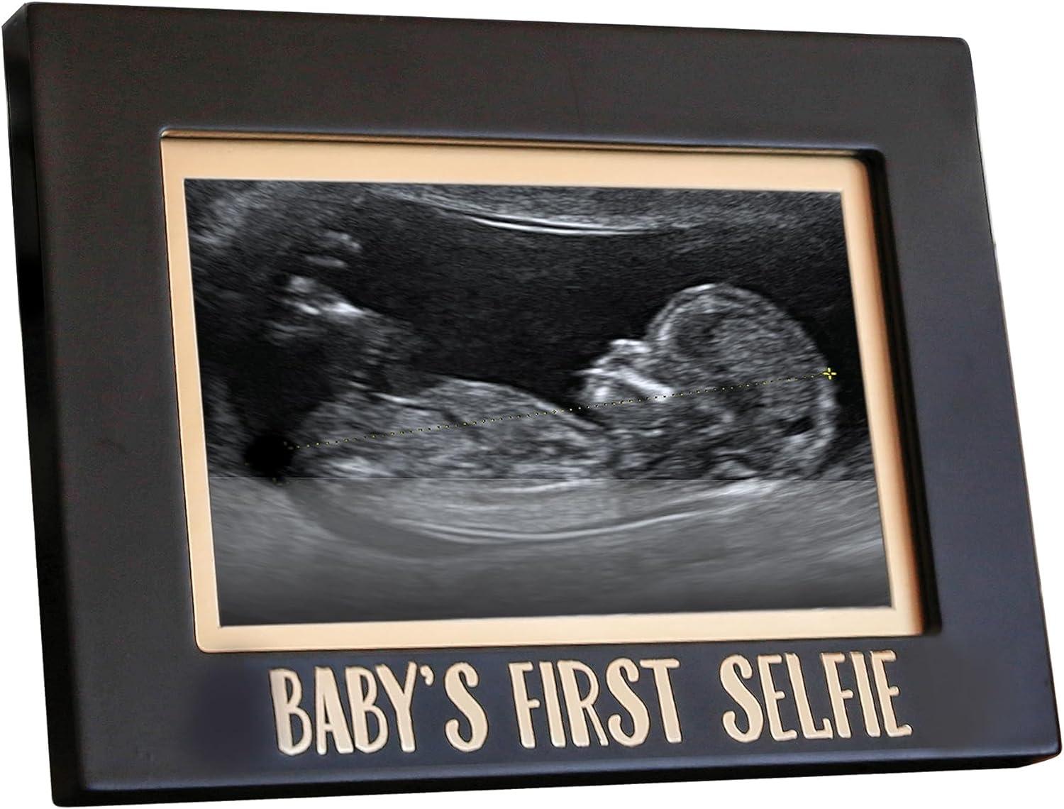 Baby Ultrasound Picture Frame